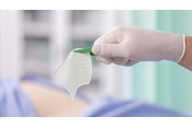 Natte exufiber met pincet